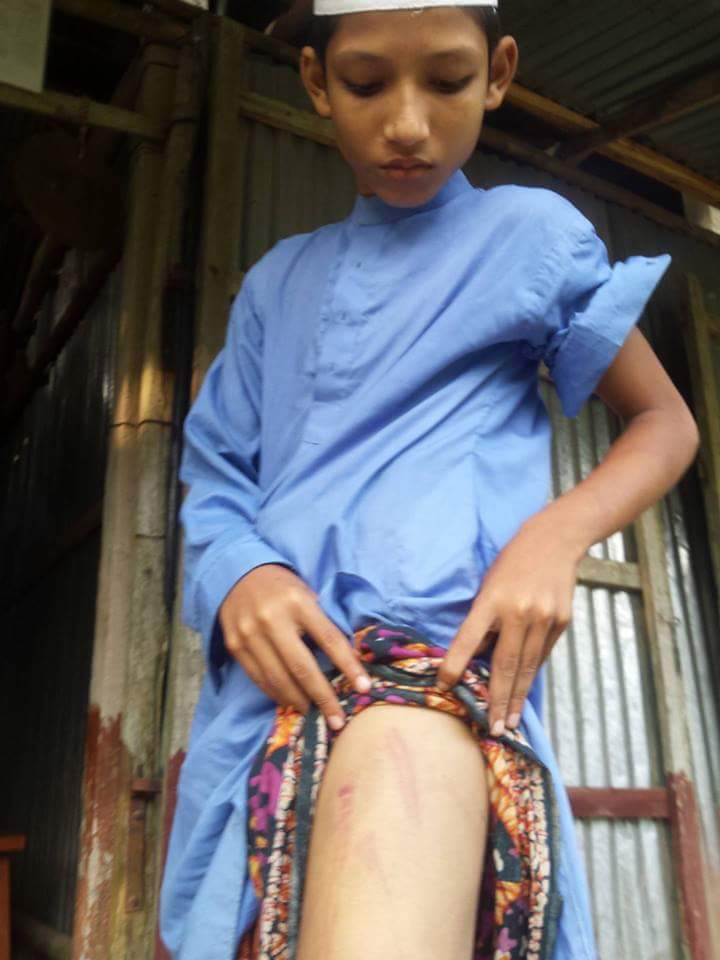 kapasia Madrasa student torture 18.09.2018 pic2